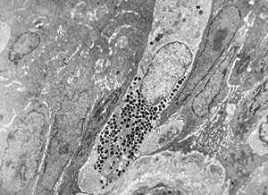 Kulchitsky enteroendocrine cell Kulchitsky enteroendocrine cell